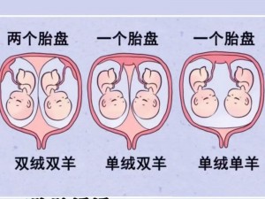 共生双胞胎_什么是共生双胞胎？他们有哪些特别之处？